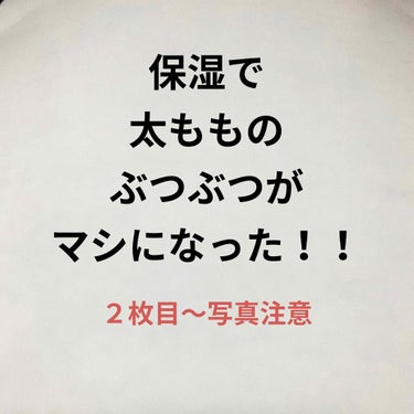 結果から言うと、毎日化粧水つけて
保湿してたらマシになってきた！！
って感じです(^_^)

太もものお見苦しい写真失礼します。
毛とか気にしないでください！
本当に気にしないで！お願いします！笑

２