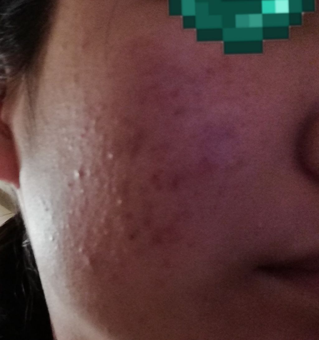 化粧水・敏感肌用・高保湿タイプ/無印良品/化粧水を使ったクチコミ(3枚目)