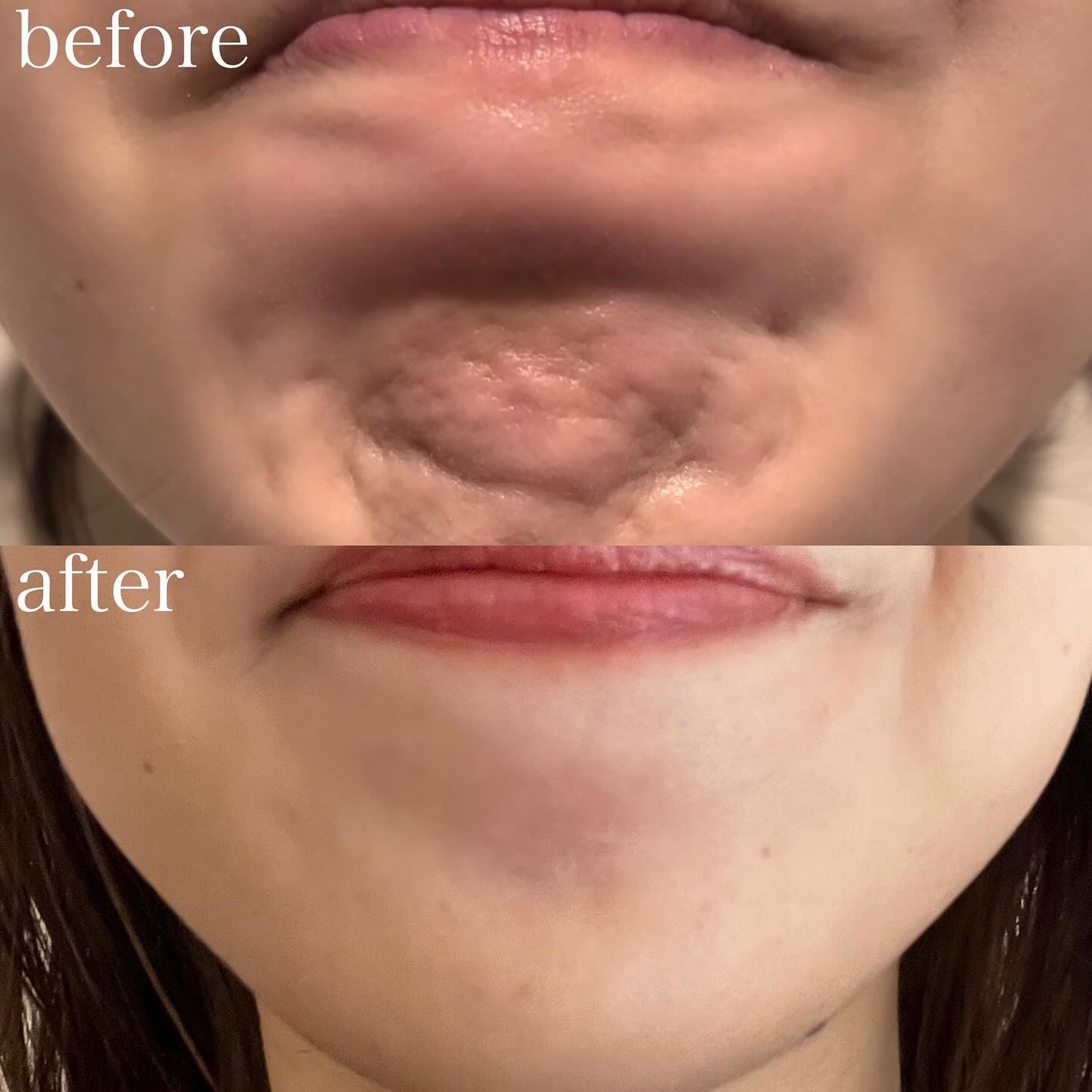 manað«§ãããã©ã§æ¥œãã倧人ã®çŸå®¹/ã³ã¹ã¡ on LIPS ããããã¯ã¹æã£ãŠããã//念é¡ã®ãããã¯ã¹æã£ãŠããããðé¡ã®..ãïŒ7æç®ïŒ