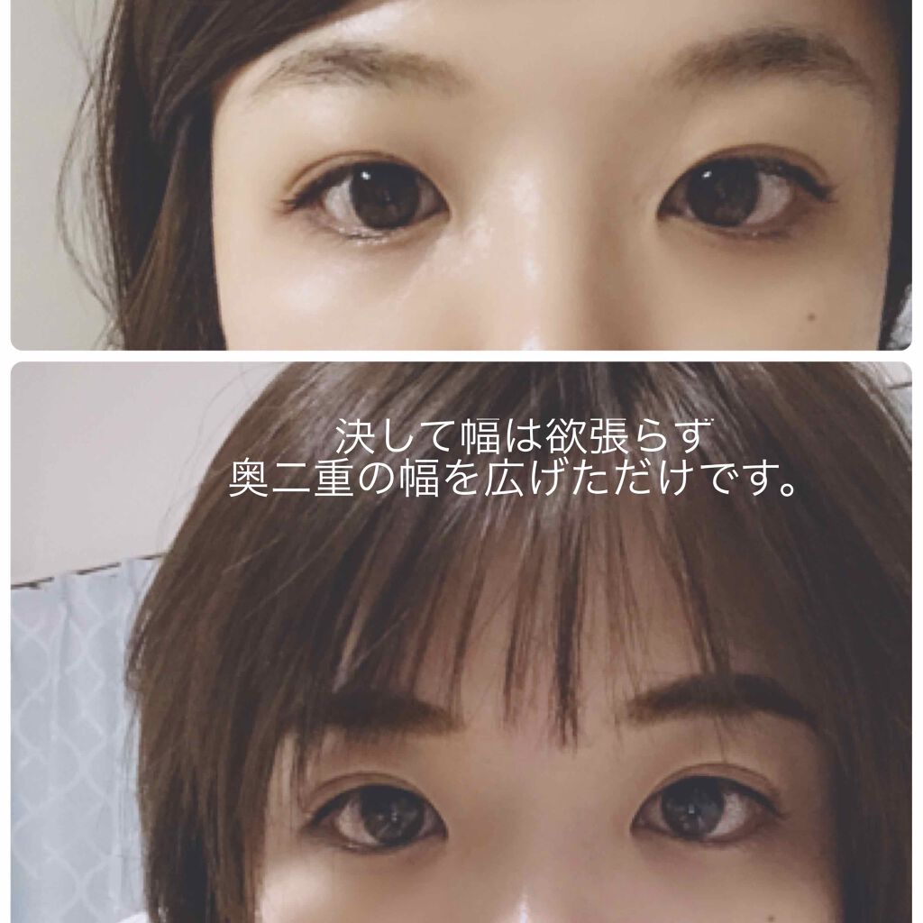 メッシュ アイテープ/shefun/二重まぶた用アイテムを使ったクチコミ(2枚目)
