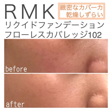 RMK RMK リクイドファンデーション フローレスカバレッジのクチコミ「カバー力×素肌感が両立できるファンデーション❕


【ＲＭＫ
    リクイドファンデーション.....」（1枚目）