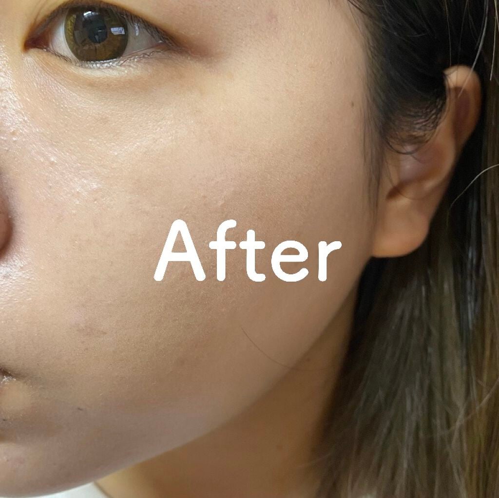 フィットミー リキッドファンデーション R/MAYBELLINE NEW YORK/リキッドファンデーションを使ったクチコミ(3枚目)