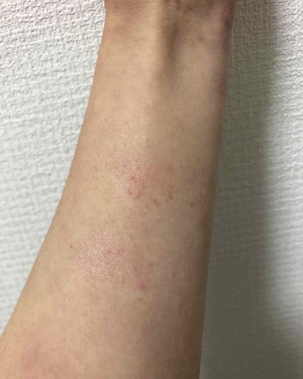 ディオール アディクト リップ グロウ オイル/Dior/リップグロスを使ったクチコミ(3枚目)