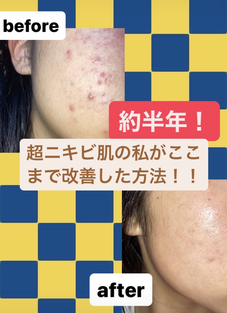 クリアケア乳液/無印良品/乳液を使ったクチコミ（1枚目）