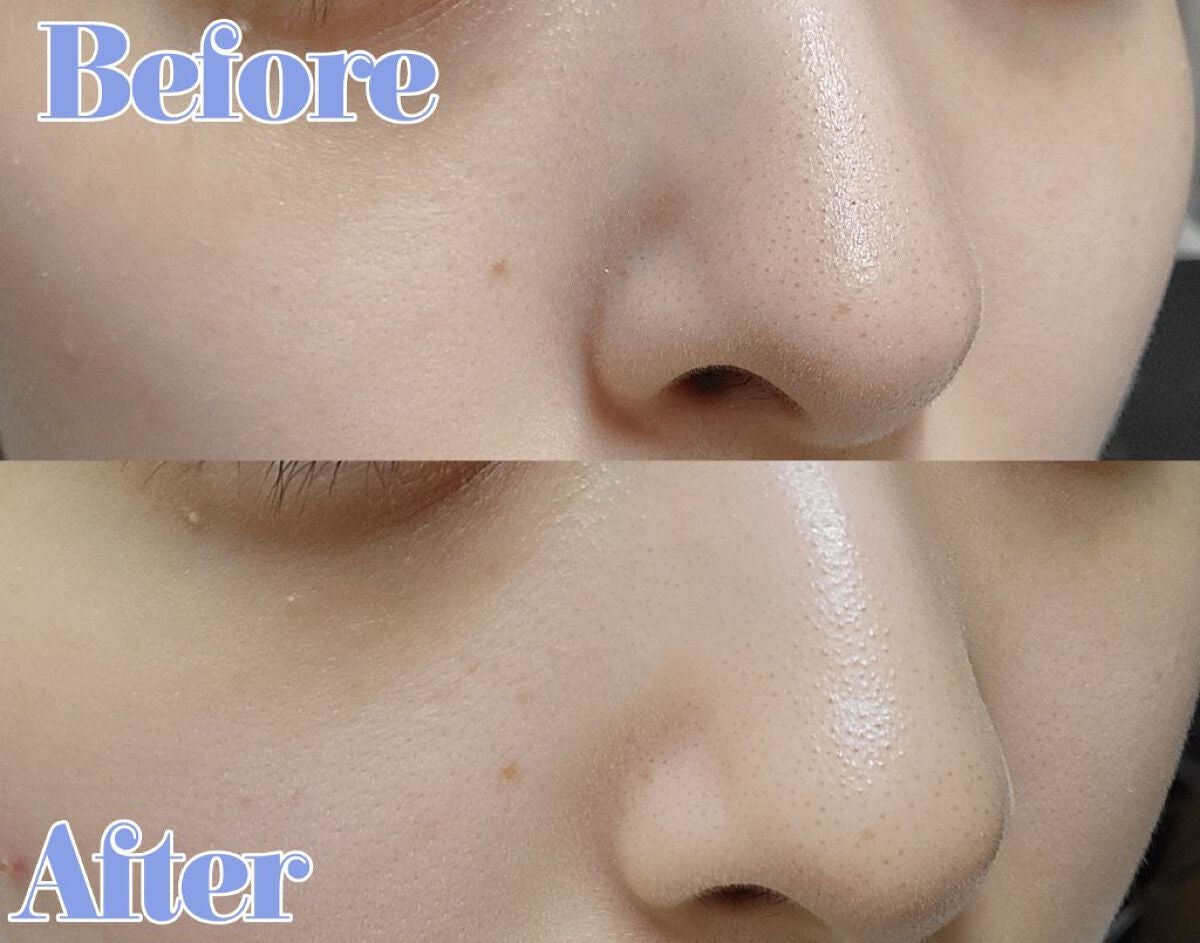 BHクリアノーズパック/CucuporeC/シートマスク・パックを使ったクチコミ(2枚目)