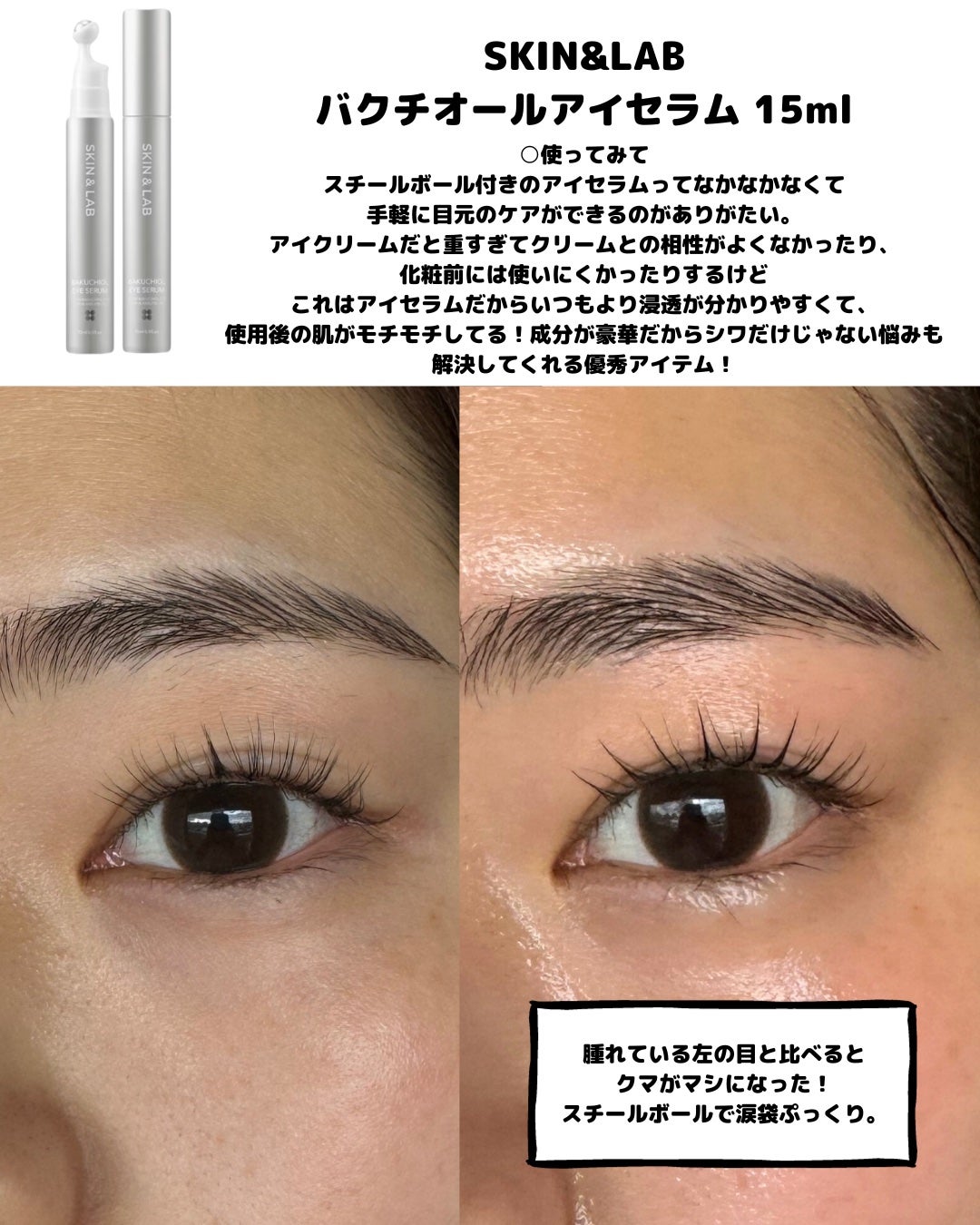 ヴィーガンリポソームレチノールセラム/SKIN&LAB/美容液を使ったクチコミ(5枚目)