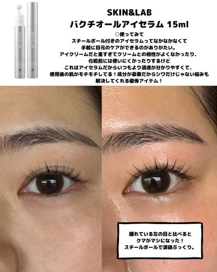 ヴィーガンリポソームレチノールセラム/SKIN&LAB/美容液を使ったクチコミ(5枚目)