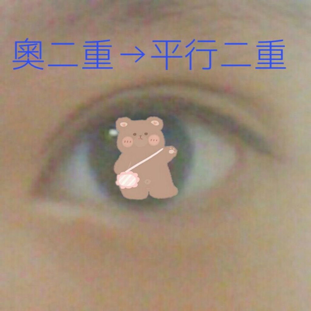 アイテープ(絆創膏タイプ、レギュラー、70枚)/DAISO/二重まぶた用アイテムを使ったクチコミ(1枚目)