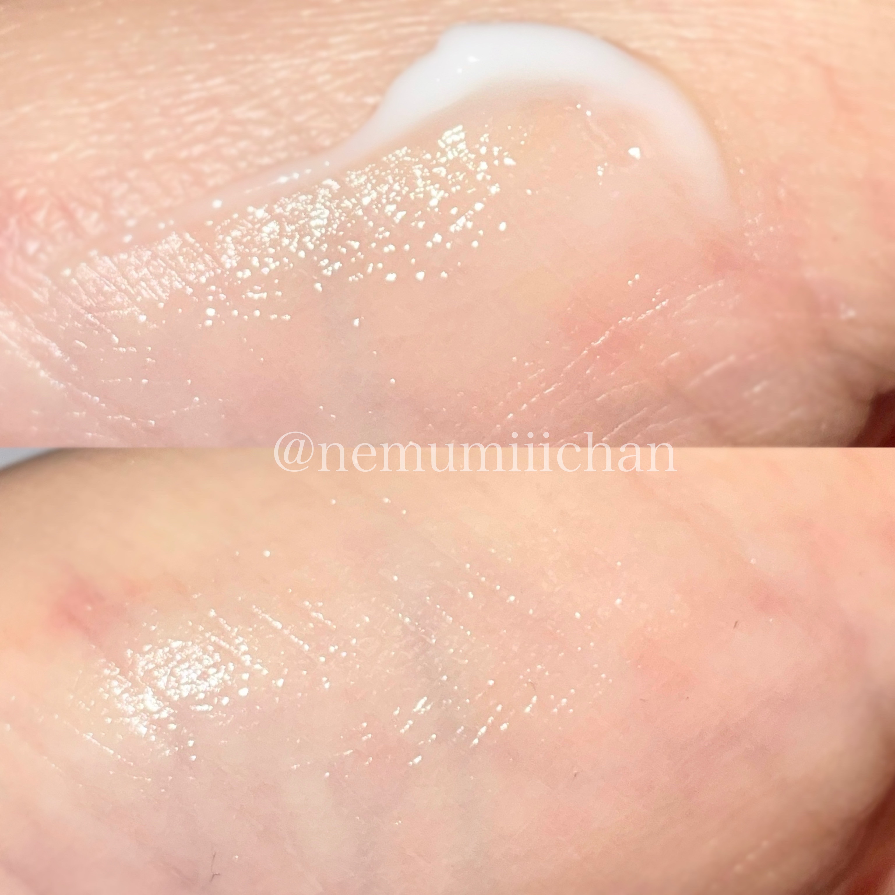 スキンリペアクリーム/d プログラム/フェイスクリームを使ったクチコミ（3枚目）