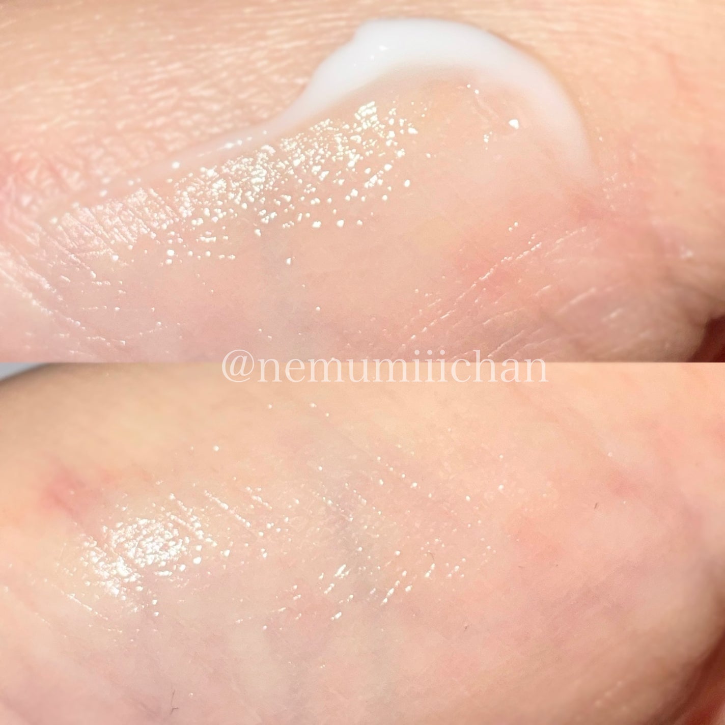 スキンリペアクリーム/d プログラム/フェイスクリームを使ったクチコミ(3枚目)