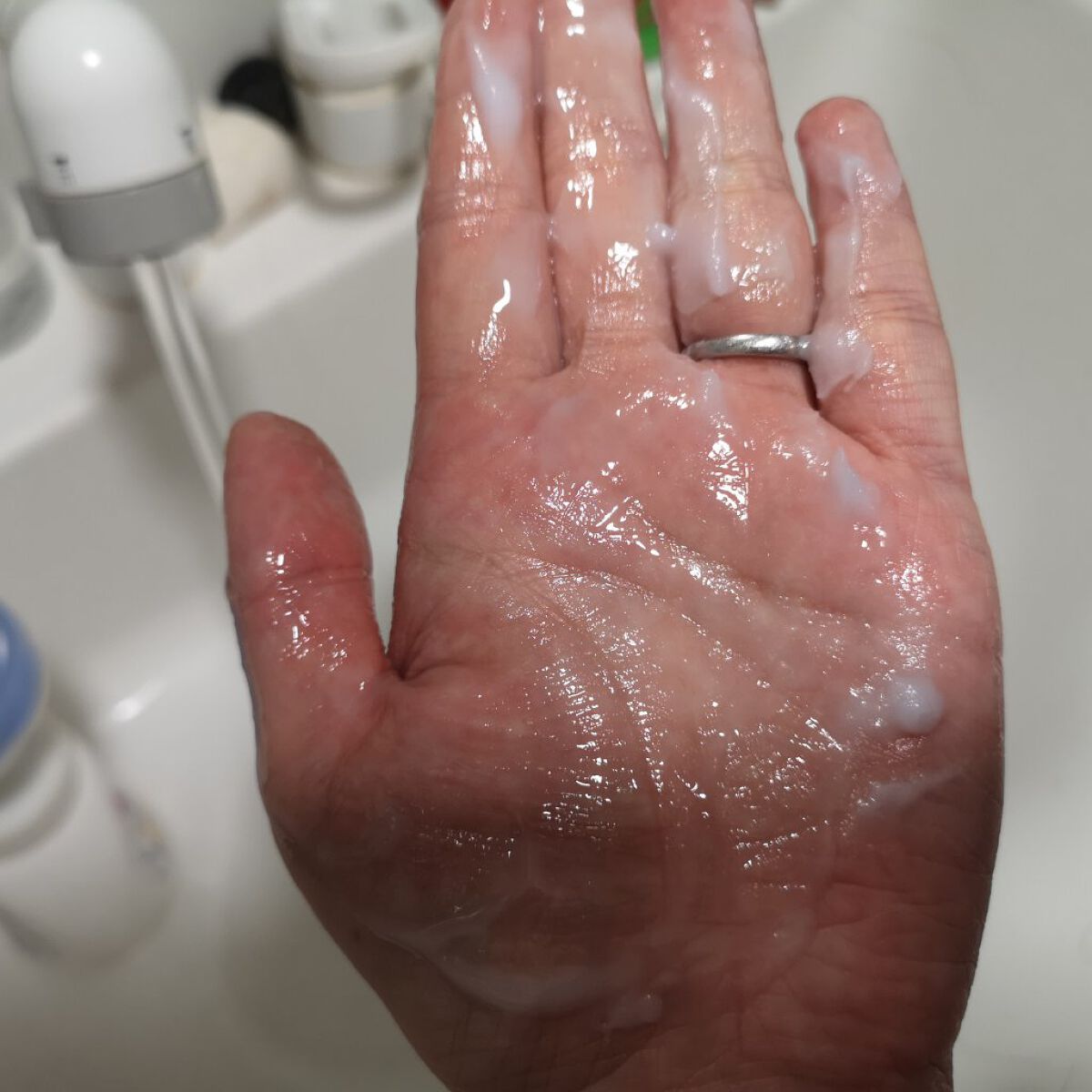 夢みるバーム アクネクリアモイスチャー/ロゼット/クレンジングバームを使ったクチコミ(5枚目)