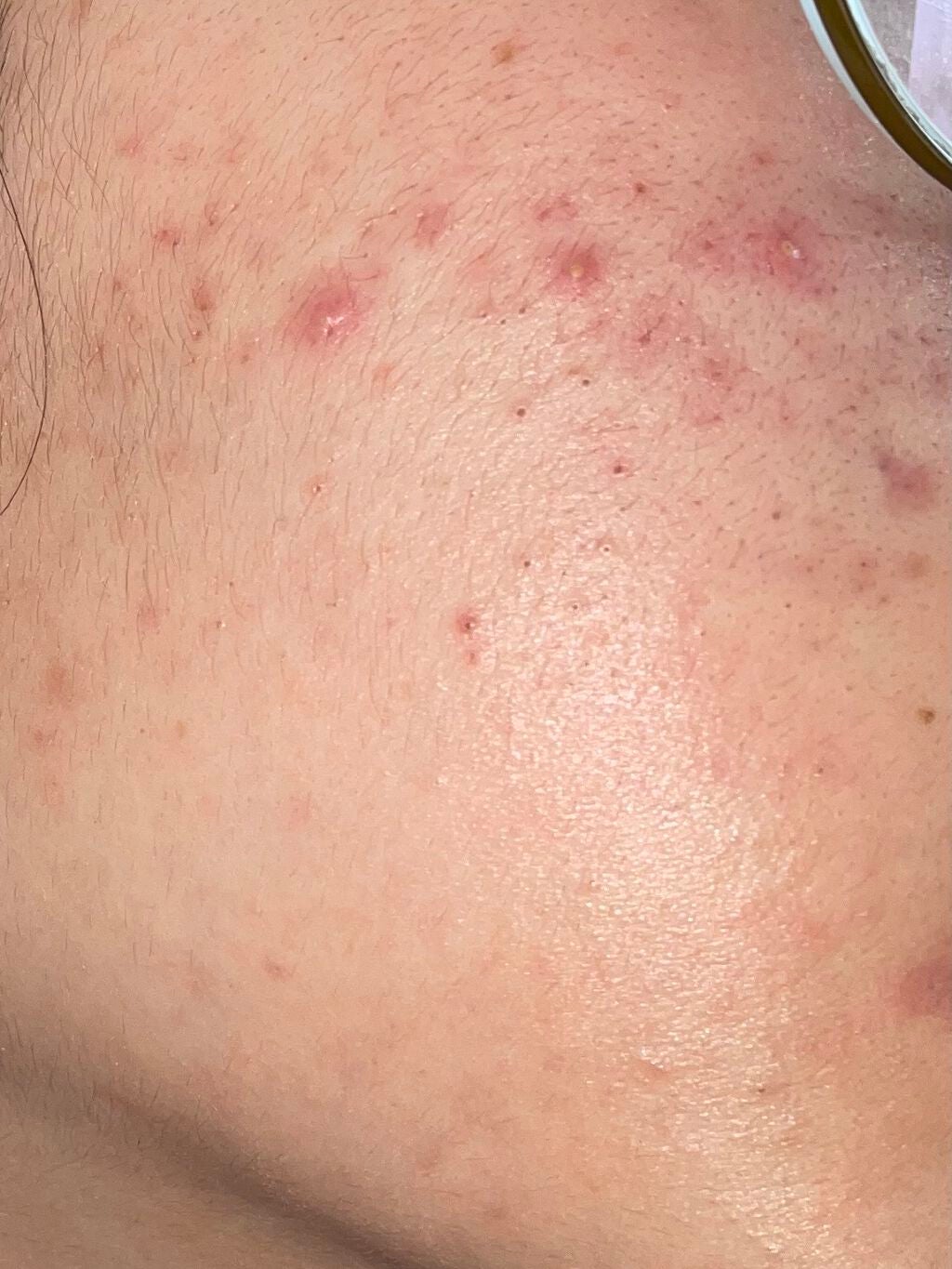 ハトムギ化粧水(ナチュリエ スキンコンディショナー R )/ナチュリエ/化粧水を使ったクチコミ(2枚目)