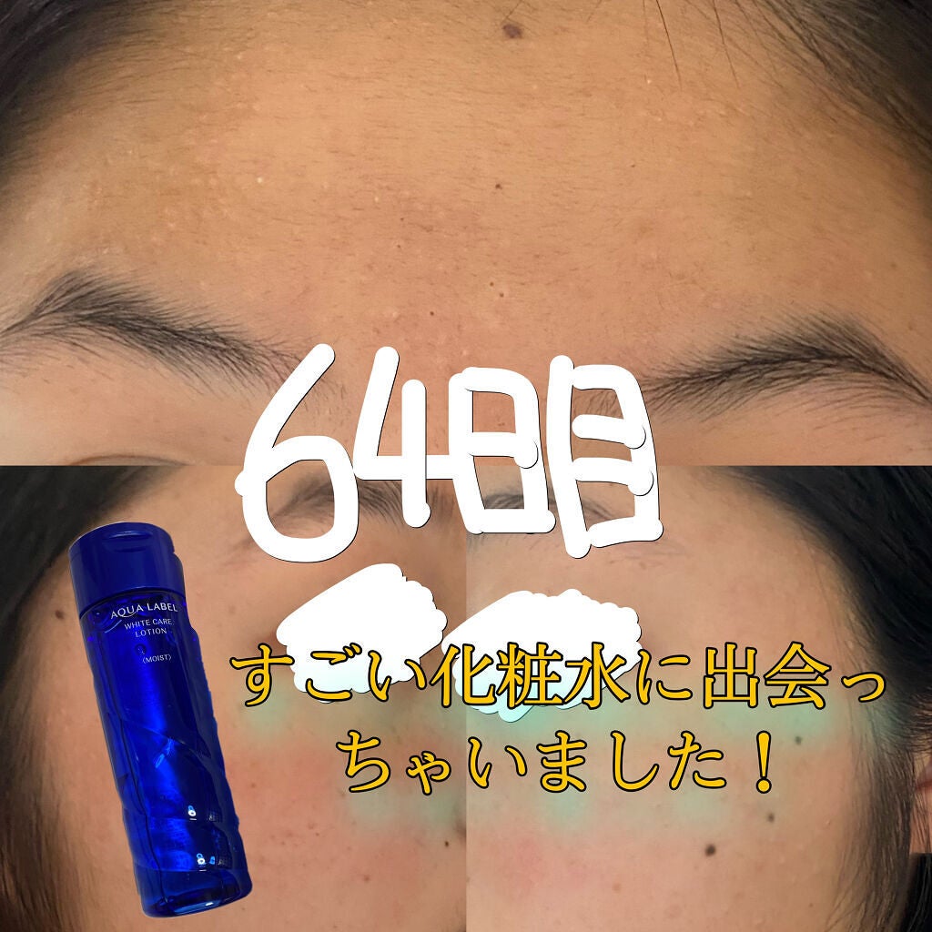 ホワイトアップ ローション(II)/アクアレーベル/化粧水を使ったクチコミ(1枚目)