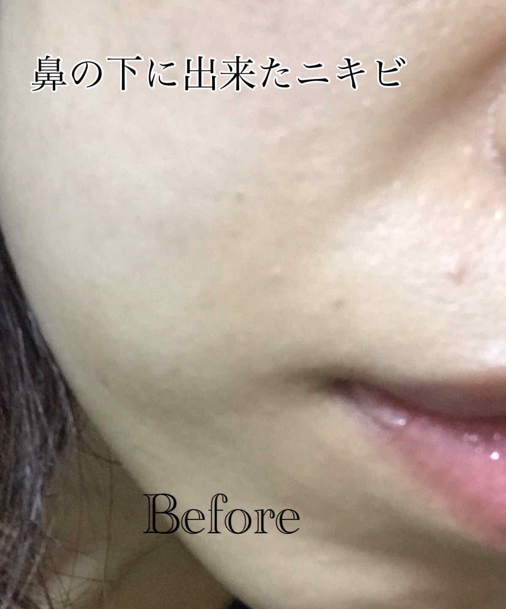 ティーツリーケア ソリューション エッセンシャルマスクEX/MEDIHEAL/シートマスク・パックを使ったクチコミ(2枚目)