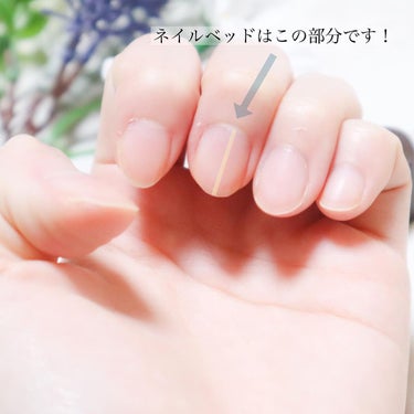 chichannnn🧸フォロバ100 on LIPS 「✩⃛/アンドネイル　ネイルベッドオイル＜爪先オイル＞使っみたの..」（3枚目）