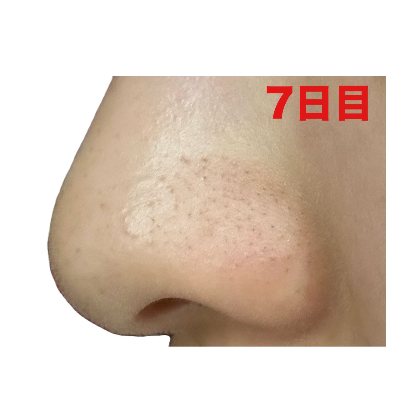 3番 緑茶炭毛穴パッククレンジングバーム/numbuzin/クレンジングバームを使ったクチコミ(9枚目)