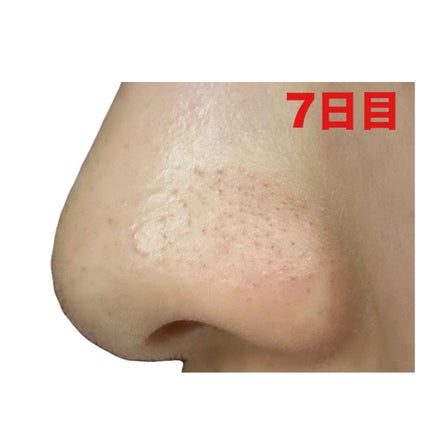 3番 緑茶炭毛穴パッククレンジングバーム/numbuzin/クレンジングバームを使ったクチコミ(9枚目)