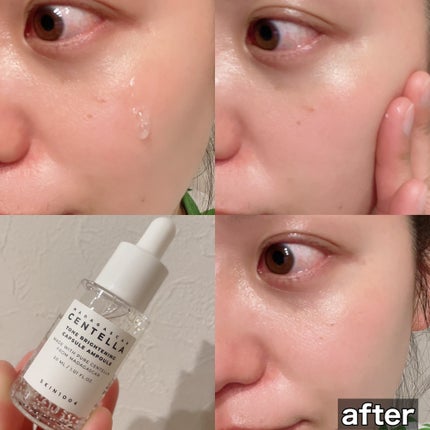 トーンブライトニング カプセルアンプル/SKIN1004/美容液を使ったクチコミ(2枚目)