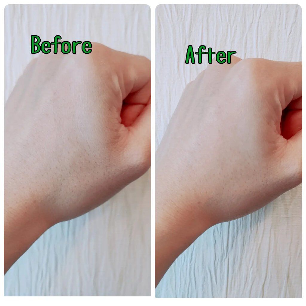 TRUECICA アクアカーミング日焼け止め/SOME BY MI/日焼け止めクリームを使ったクチコミ（2枚目）