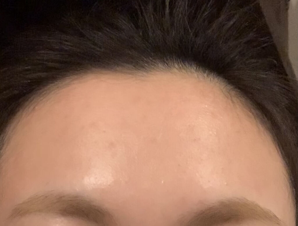 プロステージ VC100 ビタミンC モイスチャーローションリッチ/ナチュリア/化粧水を使ったクチコミ（3枚目）