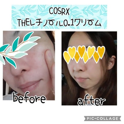 RXザ・レチノール0.1クリーム/COSRX/フェイスクリームを使ったクチコミ(4枚目)