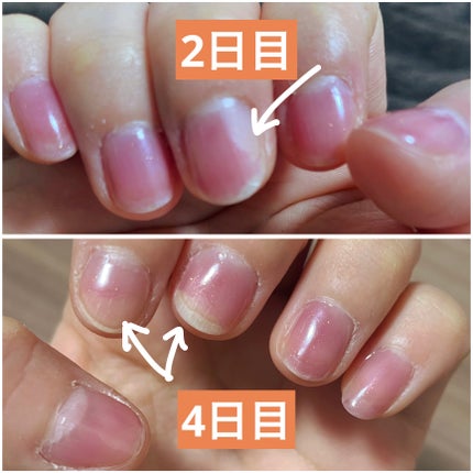 HOMEI ウィークリージェル/HOMEI/ジェルネイルを使ったクチコミ(2枚目)