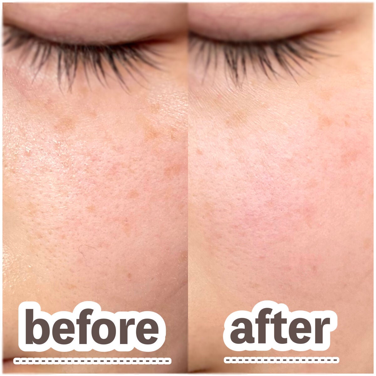 シルキールースモイストパウダー/キャンメイク/ルースパウダーを使ったクチコミ(6枚目)