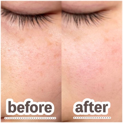 シルキールースモイストパウダー/キャンメイク/ルースパウダーを使ったクチコミ(6枚目)