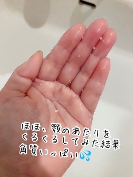 DETクリア ブライト&ピール ピーリングジェリー<ミックスフルーツの香り>/Detclear/ピーリングを使ったクチコミ(2枚目)