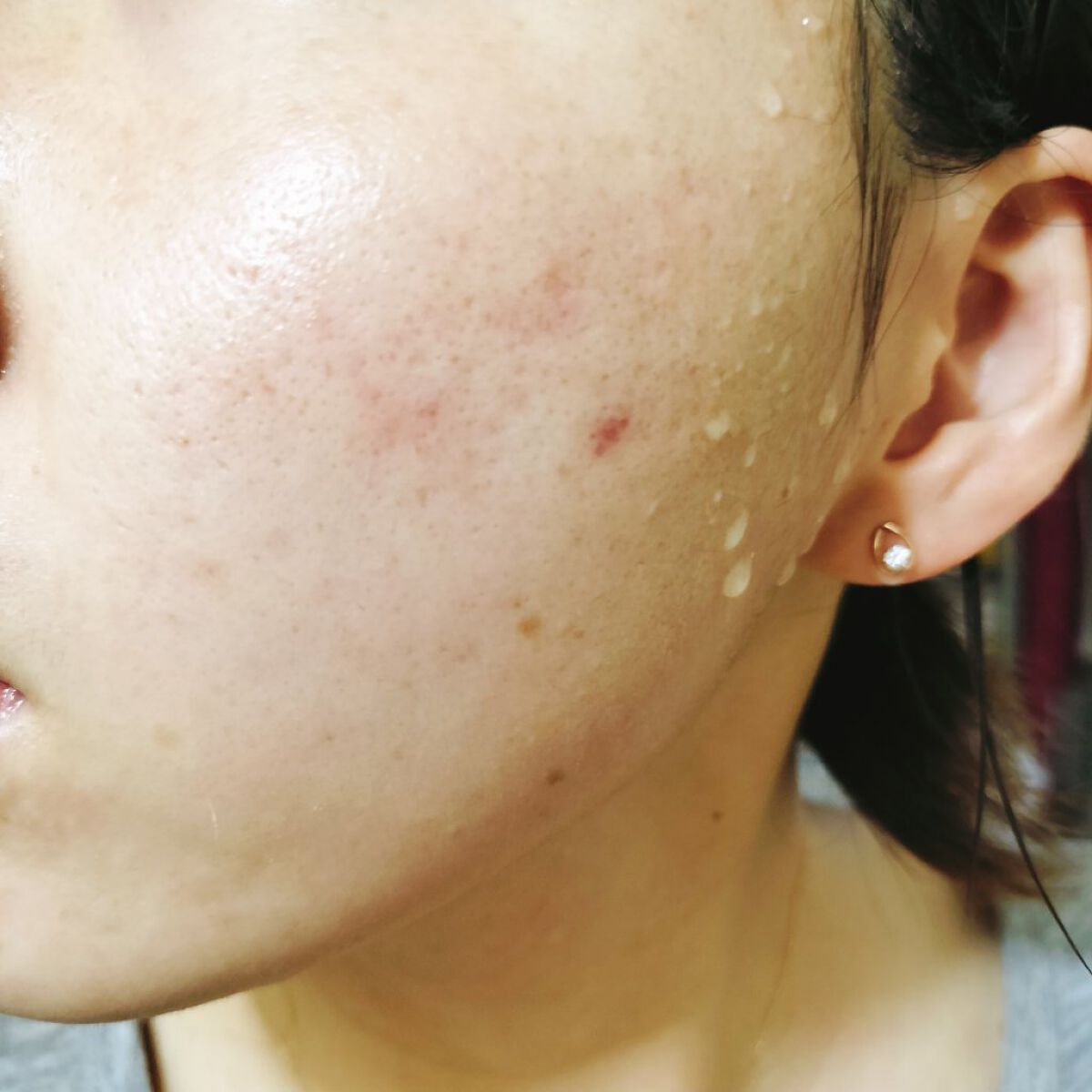 100プラントベースS/The Ordinary/美容液を使ったクチコミ（2枚目）