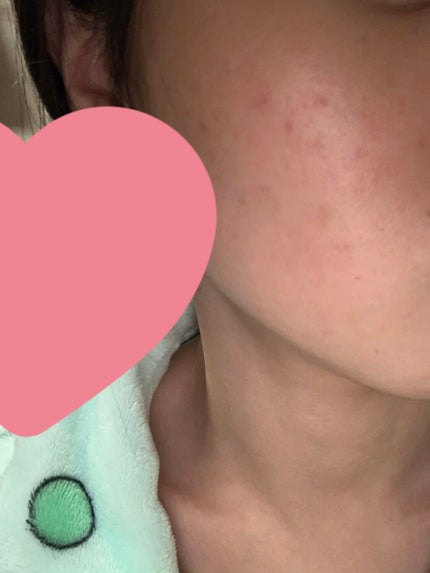 を使ったクチコミ(1枚目)