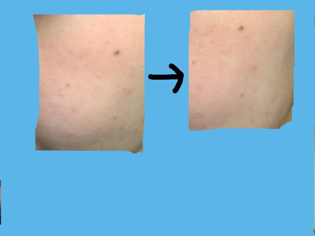 ビタペアCデイリーシートマスク/ネイチャーリパブリック/シートマスク・パックを使ったクチコミ（2枚目）