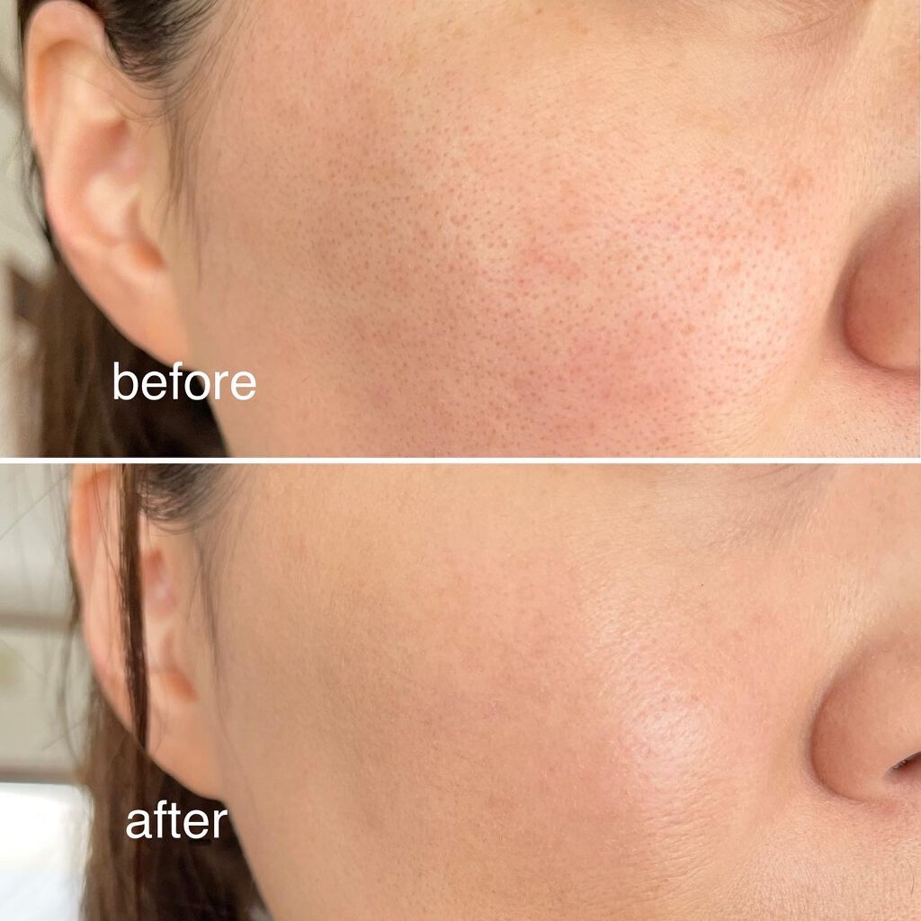 ibuharumaman on LIPS 「リキッドでもパウダーでもない?!新発想の密着ストレッチファンデ..」(6枚目)