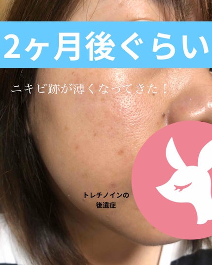 UVローション SPF50+/キュレル/日焼け止め・UVケアを使ったクチコミ(4枚目)