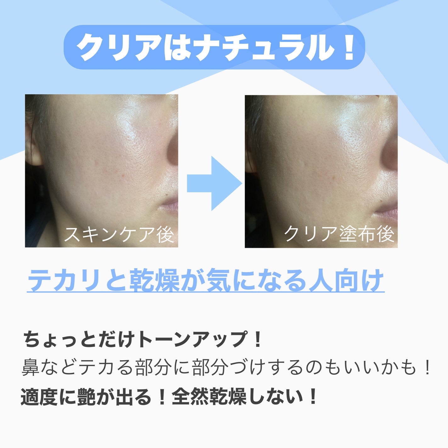 UVã€ã㢠XL ãããã¯ã·ã§ã³ããŒã³ã¢ãã ããŒãº/ã© ããã·ã¥ ããŒ/æ¥çŒãæ¢ãã¯ãªãŒã ã䜿ã£ãã¯ãã³ãïŒ6æç®ïŒ