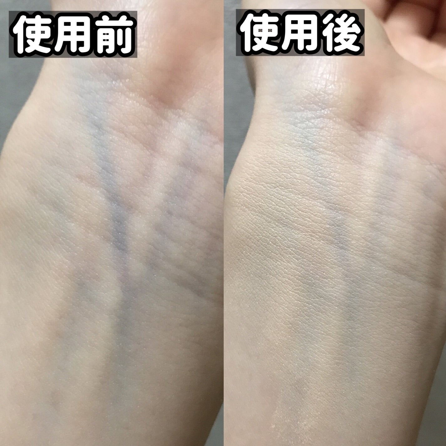 ダーマシンコンシーラー/23years old/リキッドコンシーラーを使ったクチコミ(5枚目)