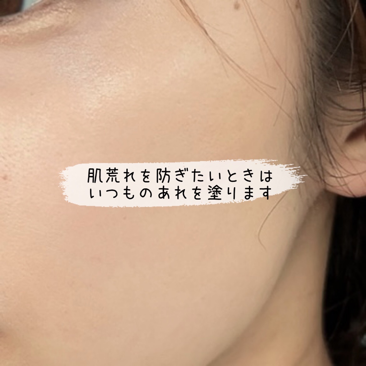 薬用しみ集中対策 プレミアム美容液/メラノCC/美容液を使ったクチコミ（1枚目）