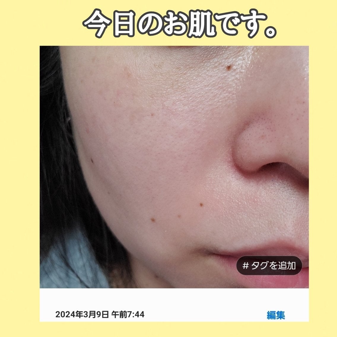 ビタリアルトーニングレーザークリーム/MEDITHERAPY/フェイスクリームを使ったクチコミ(3枚目)