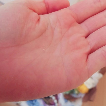 growbio/JYU-KEN/頭皮ローションを使ったクチコミ(5枚目)