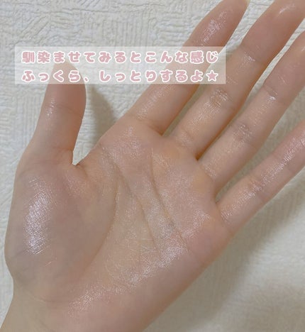 バイオイル/バイオイル/フェイスオイルを使ったクチコミ(3枚目)