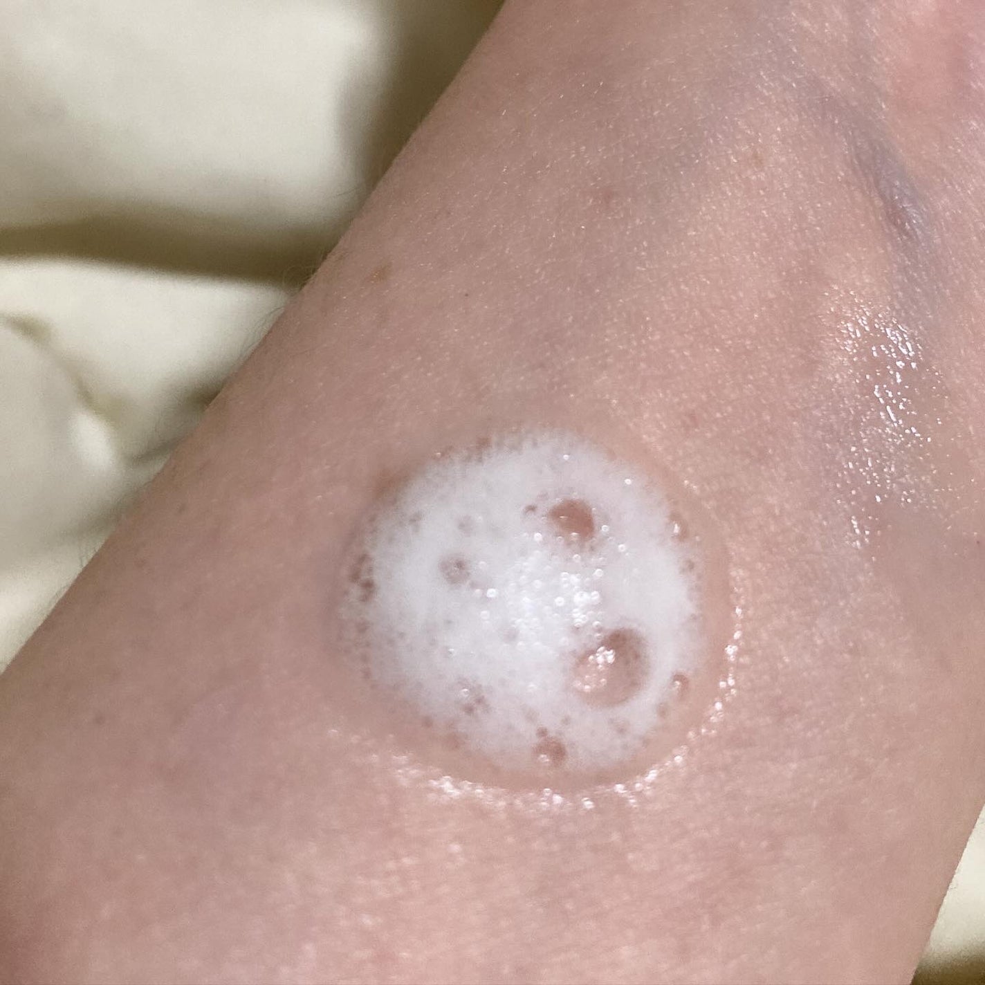 バブルエッセンス/ヒューマニズム/美容液を使ったクチコミ(4枚目)