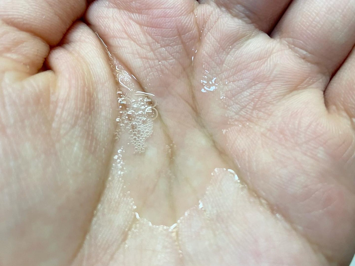 VC100エッセンスローション EX/ドクターシーラボⓇ/化粧水を使ったクチコミ(3枚目)