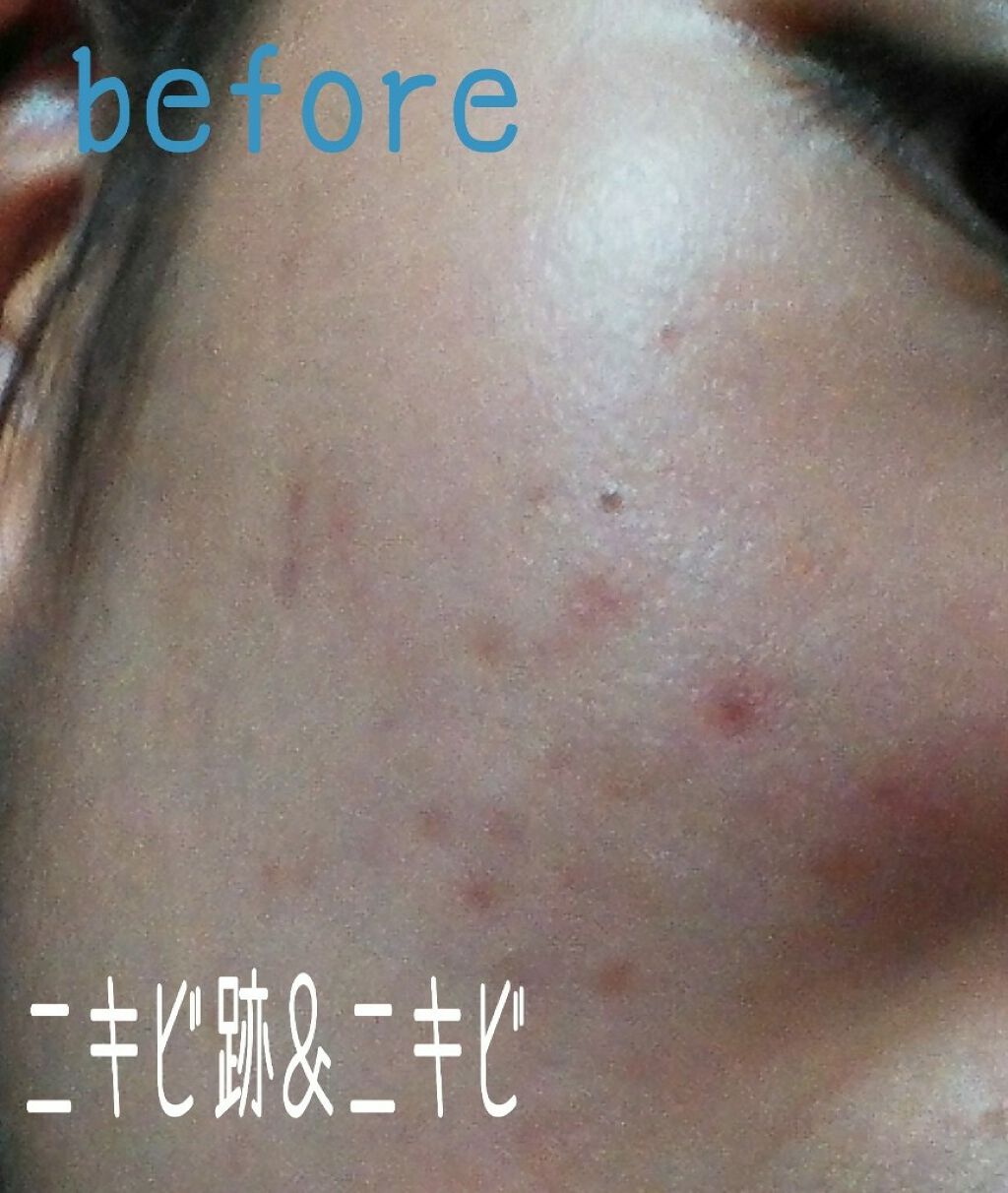 ハトムギ化粧水(ナチュリエ スキンコンディショナー R )/ナチュリエ/化粧水を使ったクチコミ（1枚目）