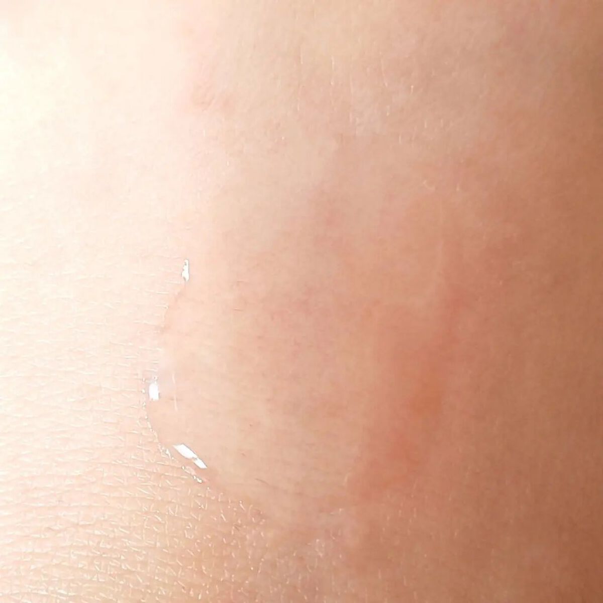 アルソフト 手指消毒ローション/サラヤ/ハンドクリームを使ったクチコミ（3枚目）