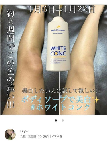 薬用ホワイトコンク ボディローション CII/ホワイトコンク/ボディローションを使ったクチコミ（2枚目）