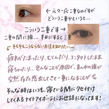 ナイトアイボーテ/StreeTrend/二重まぶた用アイテムを使ったクチコミ(2枚目)