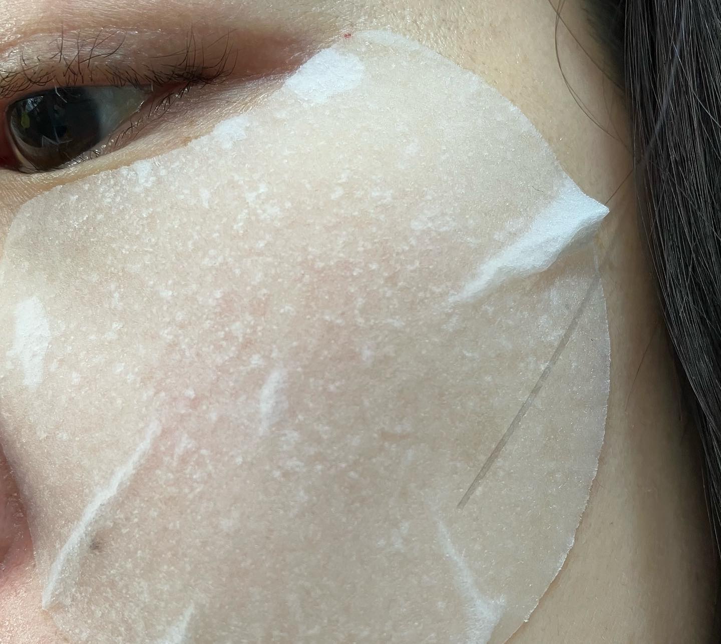 センテラ クイックカーミングパッド/SKIN1004/トナーパッドを使ったクチコミ（3枚目）