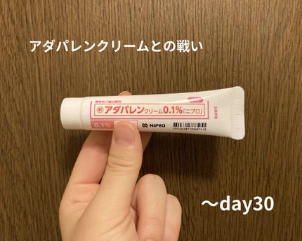 ディフェリンゲル0.1% /マルホ株式会社/その他を使ったクチコミ(1枚目)