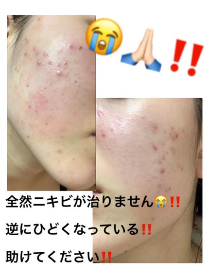 菊正宗 日本酒の化粧水 高保湿/菊正宗/化粧水を使ったクチコミ(1枚目)
