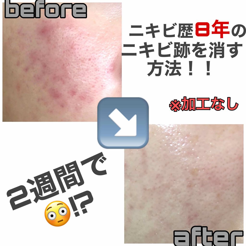 敏感肌用薬用美白美容液/無印良品/美容液を使ったクチコミ(1枚目)